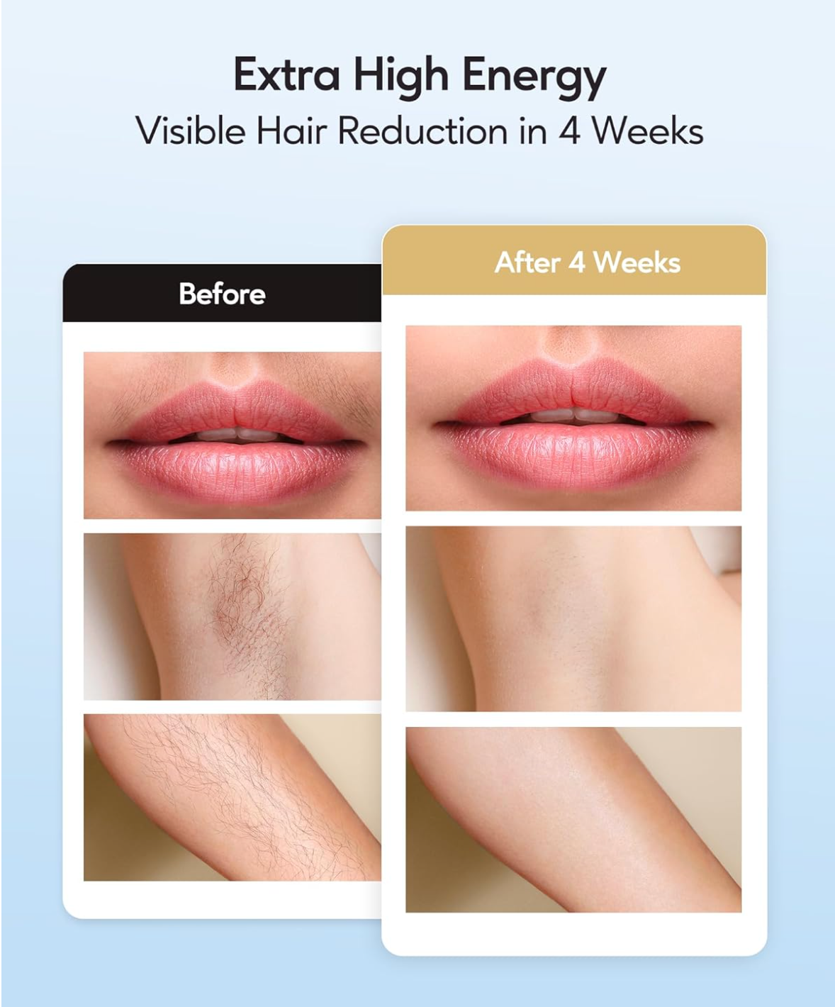 Lissea SmoothLaser – Shine with silky skin.