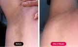 BlastLaser : “Explosive power for flawless skin.”