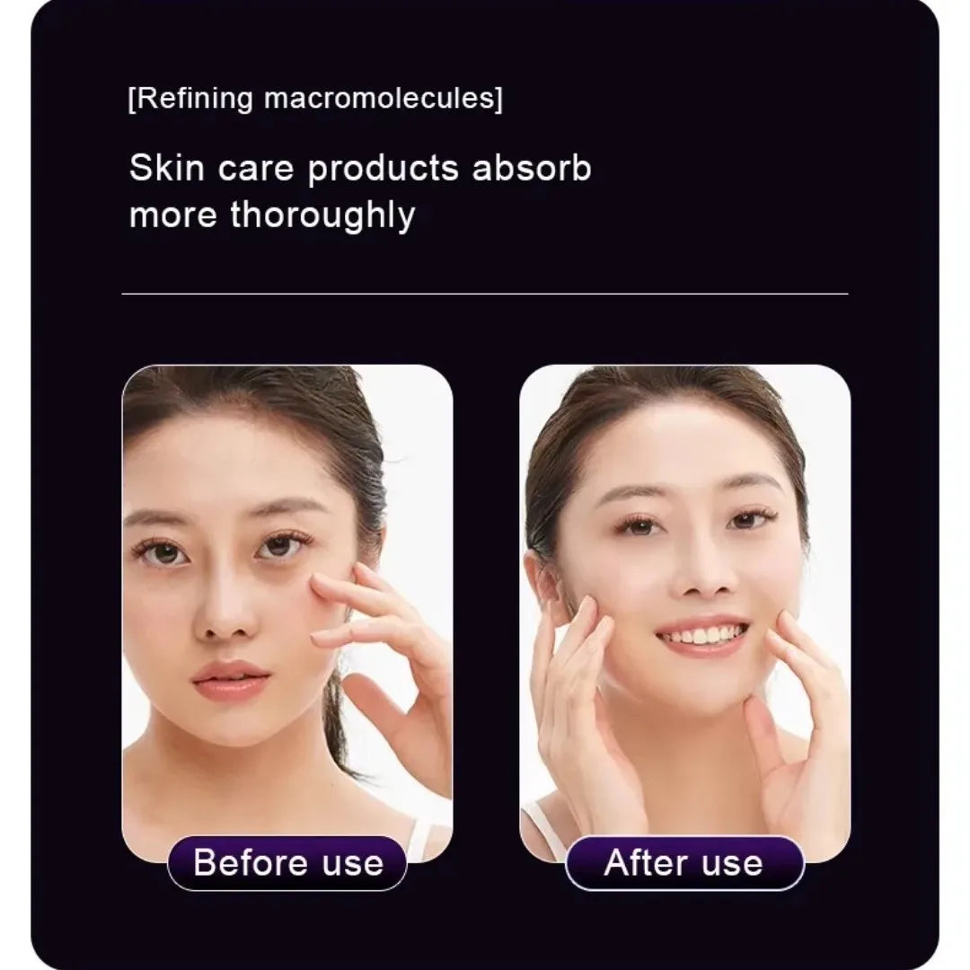LumiLift™ Renew – Advanced Facial Therapy
