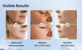 Facial Massager