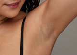 BlastLaser : “Explosive power for flawless skin.”