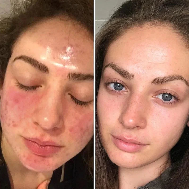 Before and after using FaceAura
